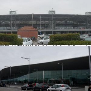 frontal views